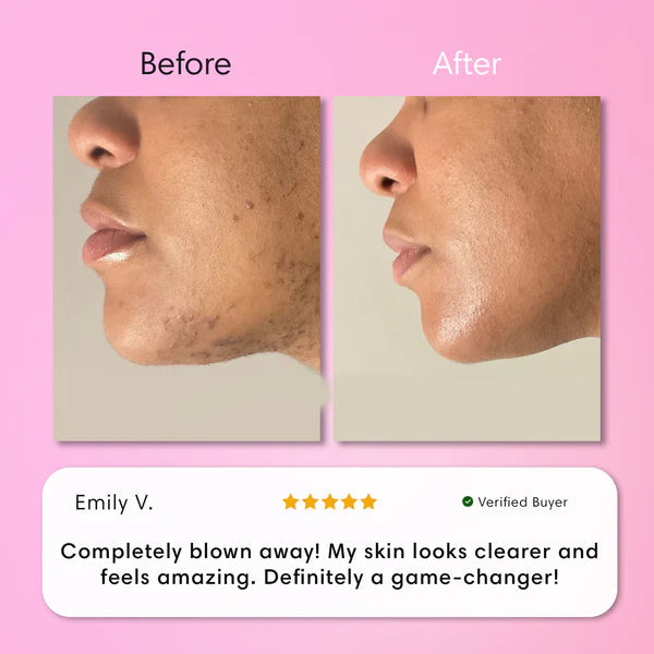 Hair Remover Kit