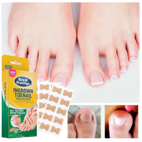Ingrown Toenails and Fungal Infections